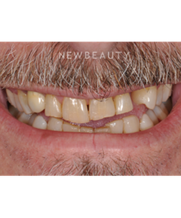 goldstein-garber-salama-smile-makeover-b