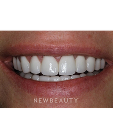 drs-goldstein-salama-a-megawatt-smile-b