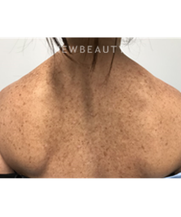 dr-marina-peredo-and-more-skinfluence-trinity-treatment-b