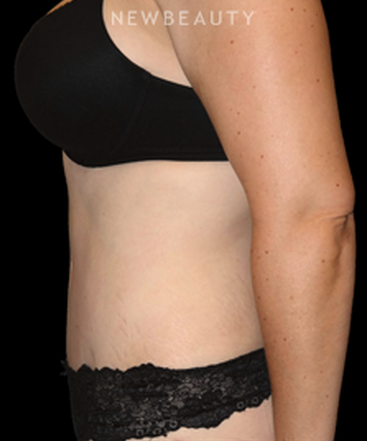 dr-bryan-w-gawley-sculpted-silhouette-b
