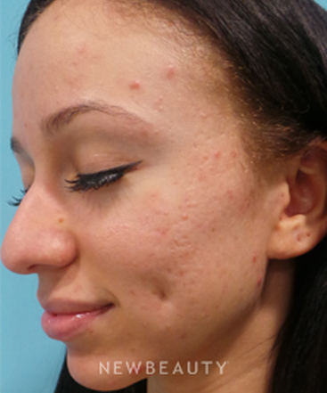 dr-sean-simon-fresh-and-clear-skin-b