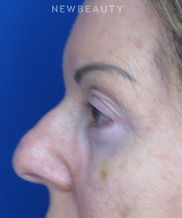 dr-joseph-russo-refreshed-and-restored-eye-ebg-b