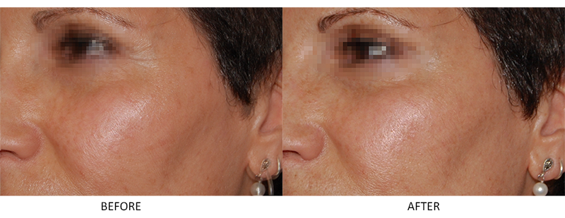 Gold Collagen Supplement - Anti-Aging - Skin Care - DailyBeauty - The