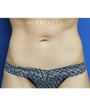 dr-joseph-russo-sculpted-silhouette-b